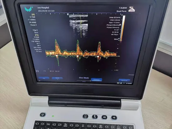 Portable-Radio-Brushless Motor Design-4000mAh Battery-Cordless/Electric-Car/Floor/Garden/Walls/Flowers...etc-Power Tools/Cleaning Machine-High Pressure Washer